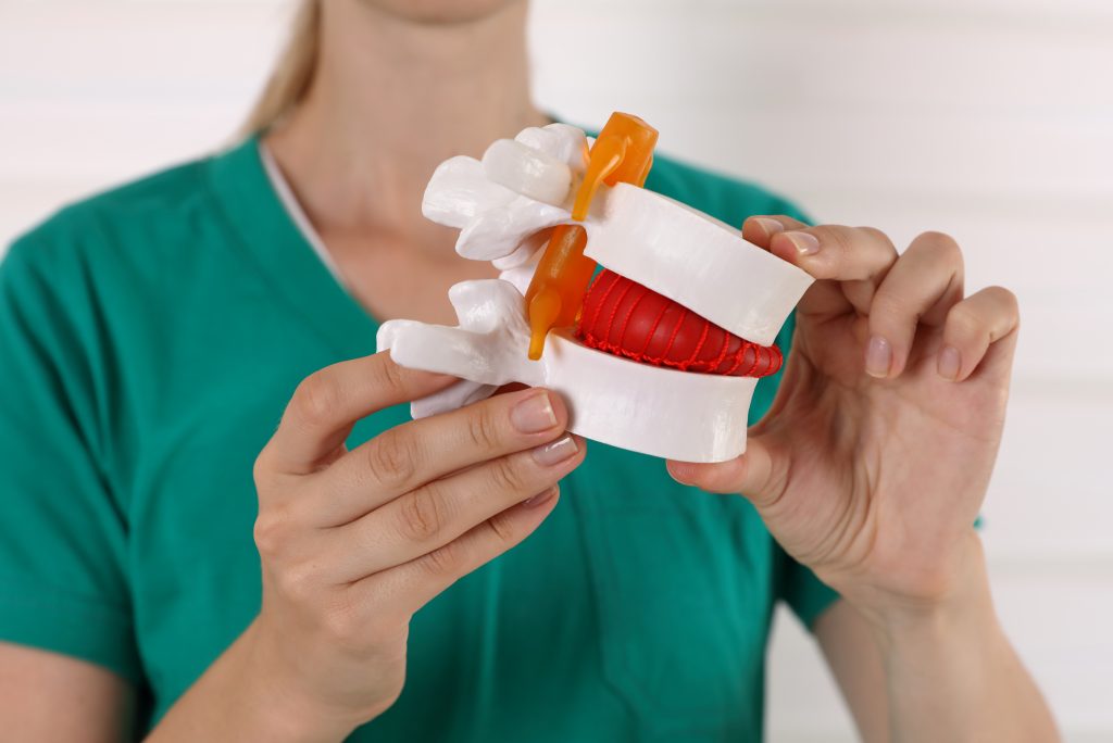 Pflegefachkraft hält ein anatomisches Modell der Wirbelsäule mit Bandscheibe in den Händen.