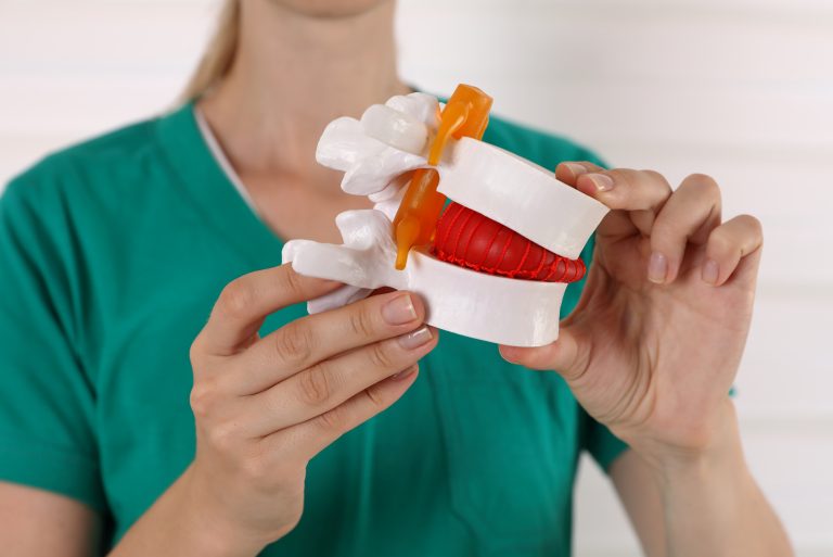 Pflegefachkraft hält ein anatomisches Modell der Wirbelsäule mit Bandscheibe in den Händen.